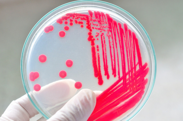 Gloved fingers holding lab dish with red scratches and dots of bacteria on clear growing media; concept is testing for C. diff 